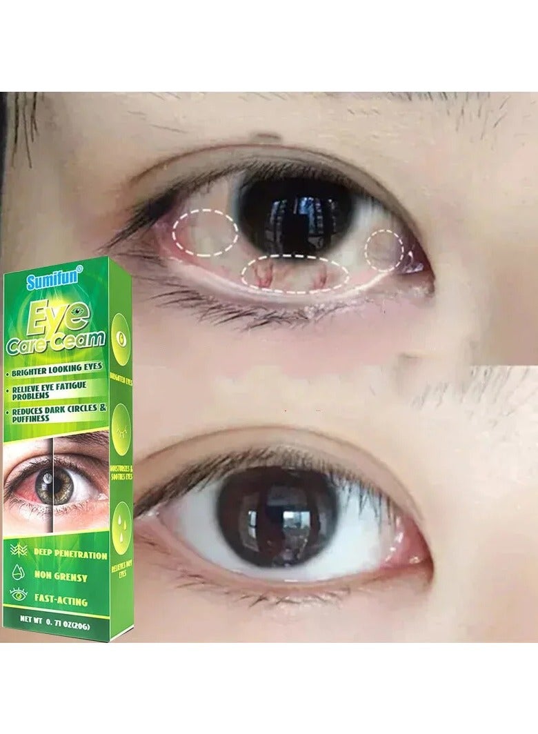 Sumifun كريم العناية بالعيون من الطب الصيني بالأعشاب لتخفيف تعب العيون وتقليل الهالات السوداء والانتفاخات لعيون أكثر إشراقاً - Image 2
