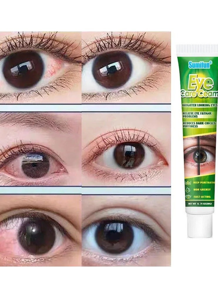 Sumifun كريم العناية بالعيون من الطب الصيني بالأعشاب لتخفيف تعب العيون وتقليل الهالات السوداء والانتفاخات لعيون أكثر إشراقاً - Image 3