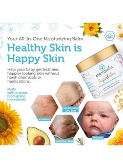 Era Organics Healing Ointment For Babies Usda Certified Organic Natural Gentle Moisturizer For Sensitive Skin Prone To Baby Eczema Cradle Cap (Infant Seborrheic Dermatitis) Rashes Hives & More  - Image 3