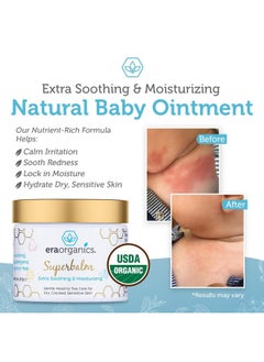 Era Organics Healing Ointment For Babies Usda Certified Organic Natural Gentle Moisturizer For Sensitive Skin Prone To Baby Eczema Cradle Cap (Infant Seborrheic Dermatitis) Rashes Hives & More  - Image 5
