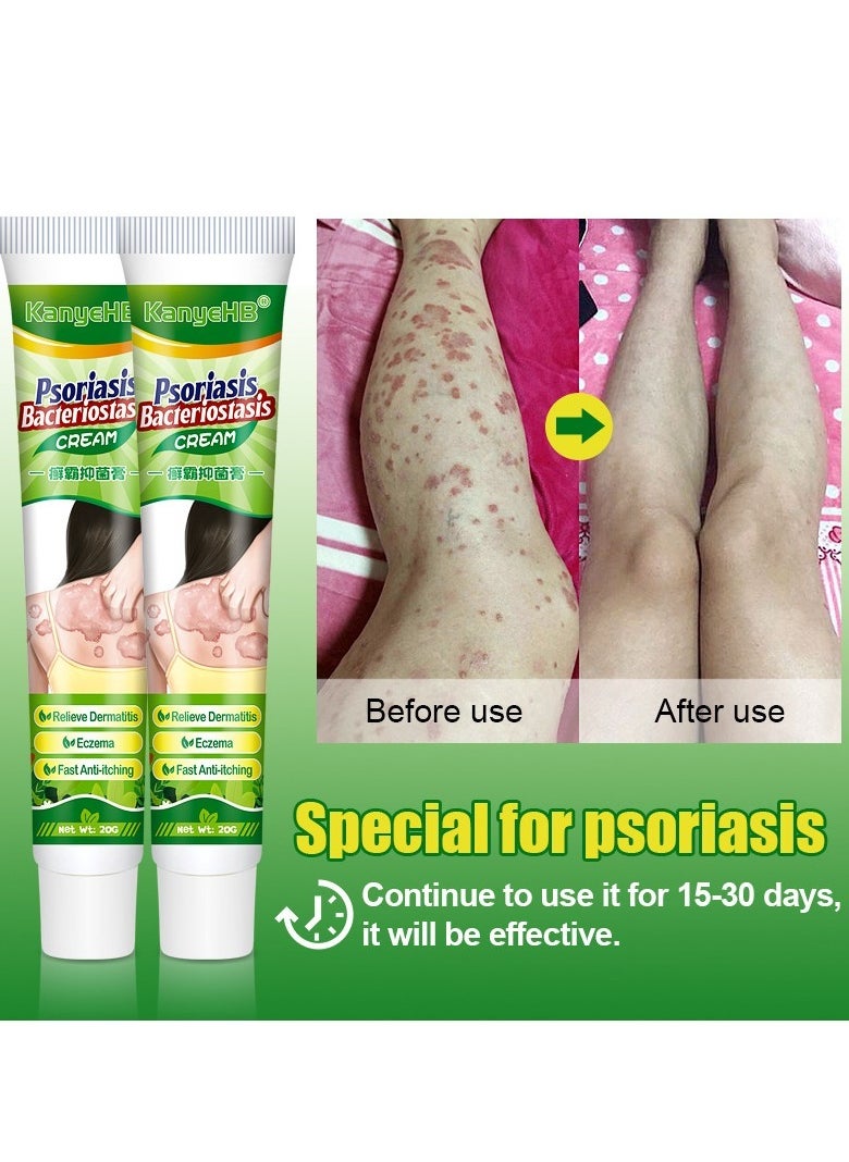 Antibacterial Cream for Psoriasis and Eczema Antifungal Cream, Helps Eczema, Ringworm Anti-Itch Cream with Gentler and Safer Herbal Ingredients Quickly Relives Itching for Face & Body - pzsku/Z0BA6D98974F82F369ABCZ/45/_/1738912637/9047b7bd-849a-41b0-a993-03f9d7332a01