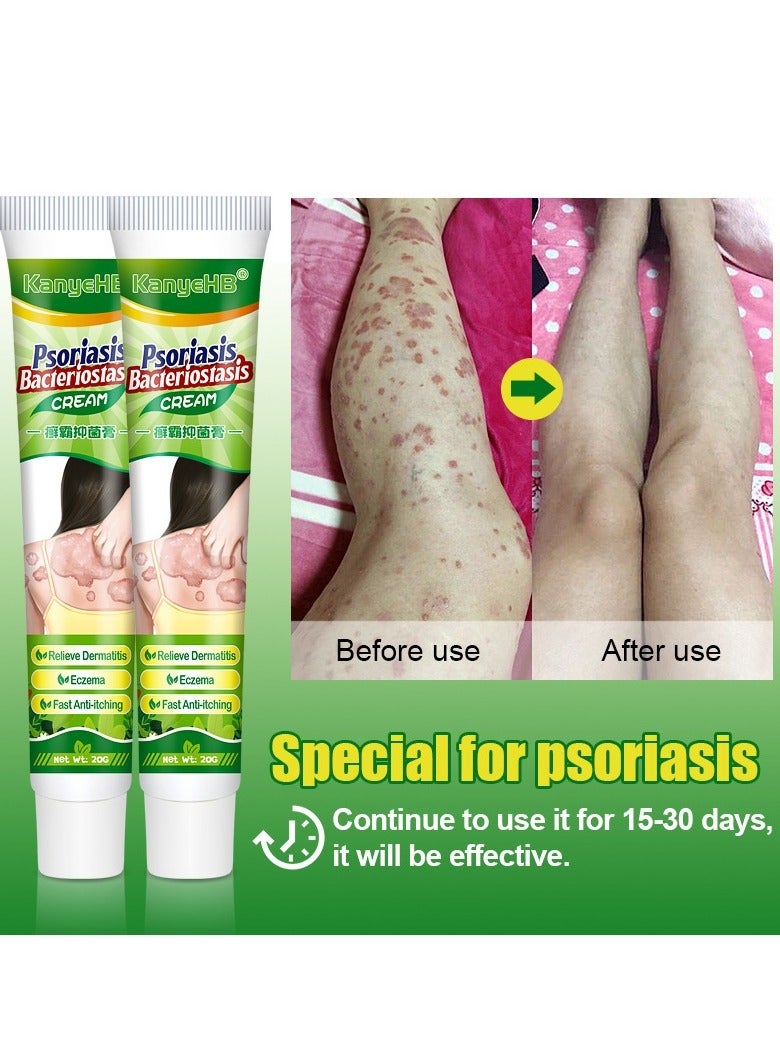 KanyeHB Antibacterial Cream for Psoriasis and Eczema Antifungal Cream, Helps Eczema, Ringworm Anti-Itch Cream with Gentler and Safer Herbal Ingredients Quickly Relives Itching for Face & Body - Image 3