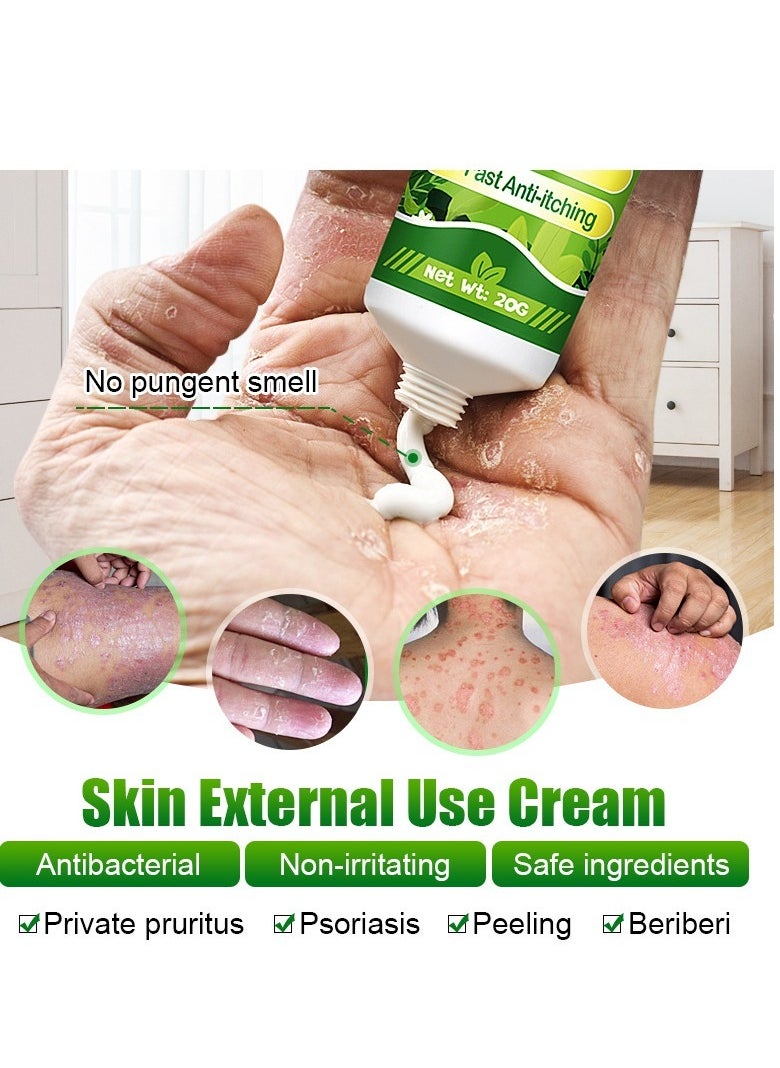 Antibacterial Cream for Psoriasis and Eczema Antifungal Cream, Helps Eczema, Ringworm Anti-Itch Cream with Gentler and Safer Herbal Ingredients Quickly Relives Itching for Face & Body - pzsku/Z0BA6D98974F82F369ABCZ/45/_/1738912638/c06c0bc3-e3f3-4627-a313-32e3004bf862