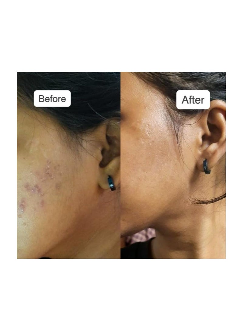 vilvah STORE Milk Drops Brightening Serum Formulated With Rice Milk Extract, Marine Algae Extract, Alpha Arbutin, Fades Scars, Brightens Skin & Even Skin Tone For All Skin Type, 20ml - Image 4