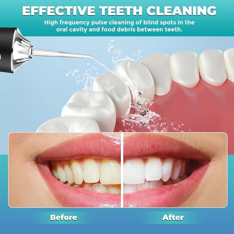 ALKAYAN Portable Oral Irrigator l Power & Irrigator, 3 Modes Soft Normal Pulse, 220ml... - Image 2