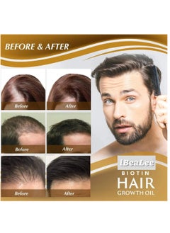 iBealee Biotin Premium Hair Growth Serum Stronger Thicker Longer Hair Reduce Hair Loss Restore Thinning Hair Nourishes Hair & Scalp All Hair Types for Men & Women  - Image 3