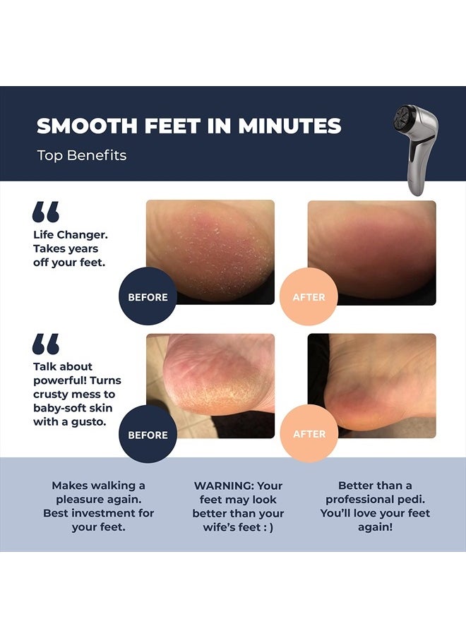 Own Harmony - Electric Foot Callus Remover with Vacuum - Own Harmony Professional Pedicure Tools Kit for Powerful Pedi Feet Care Vac, Electronic Foot File CR2100, Best for Hard, Dry, Cracked, Dead Skin (3 Rollers) - Image 1