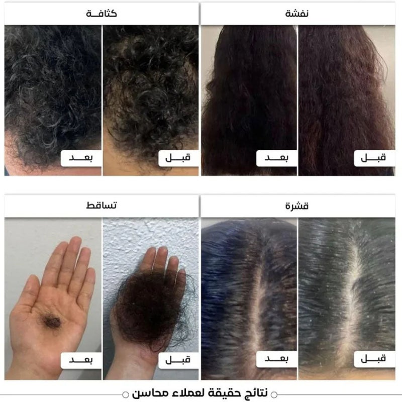 محاسن زيت محاسن الشعر 200 مل - Image 4