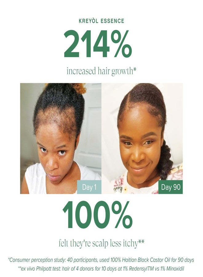 KREYÒL ESSENCE Kreyol Essence - Save Our Scalp Serum (S.O.S Serum) - Redensyl + Haitian Black Castor oil, Fuller Looking Hair, Cold Pressed Castor Oil, Natural Ingredients 1.7 oz - Image 5