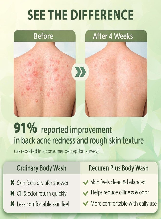 Recuren Plus Antifungal Body Wash Soap: Antibacterial, Shower Gel for Back Acne, Seborrheic Dermatitis, Folliculitis, Psoriasis, Jock Itch & Ringworm (10 Fl Oz (Pack of 1, Herbal Floral - Image 5