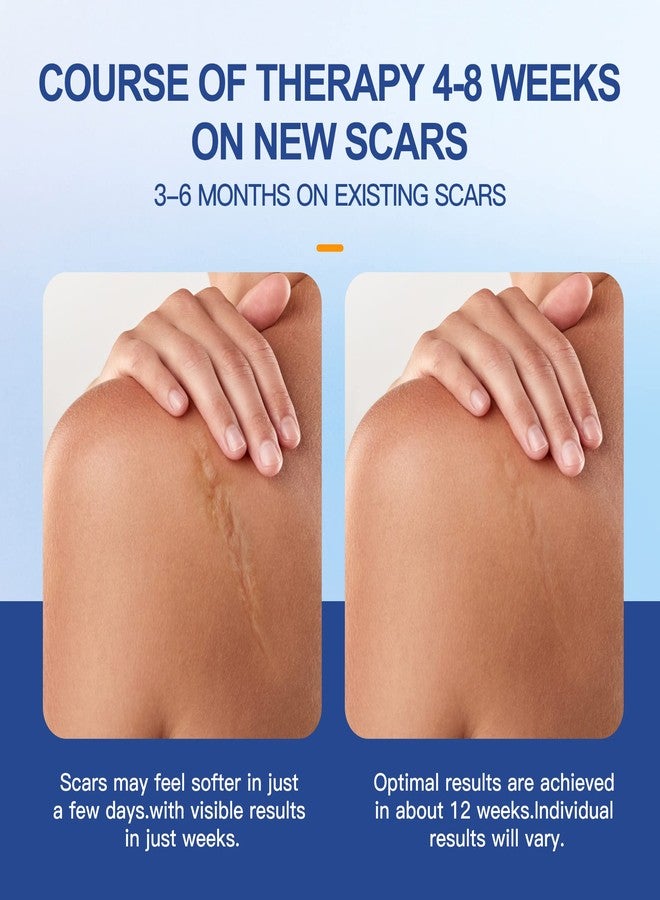 Nubical 6 Pack Large Sizes Silicone Gel Sheets 6" x 5" - Medical Sterile Packaging Silicone Scar Sheets - For Irregular Scar Removal - Image 4