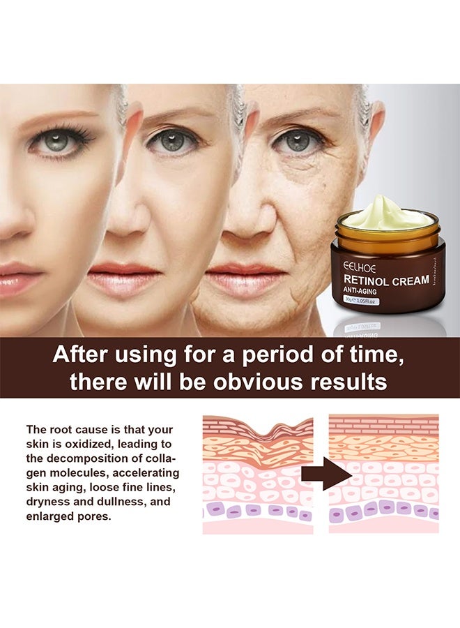 EELHOE Retinol Cream, Ant-Aging Wrinkle Firming Cream, Retinol Firming and Revitalizing Cream 30g - Image 4