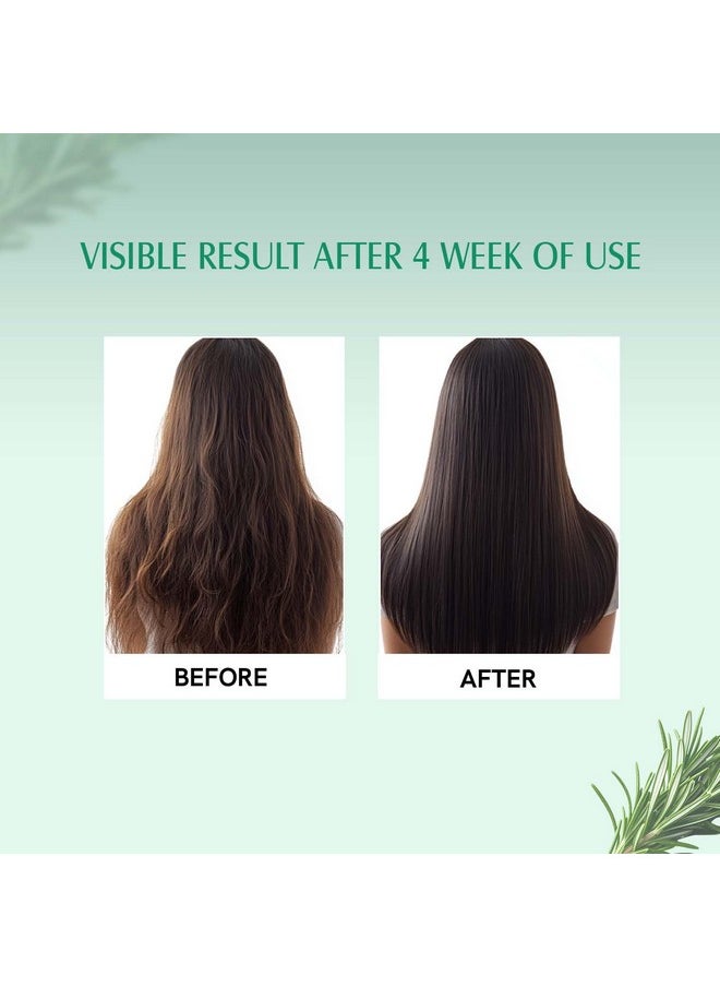 Aravi Organic Rosemary & Biotin Hair Growth Serum - For Hair Growth, Strengthens Hair, And Nourishes Scalp - 30 Ml  - Image 5