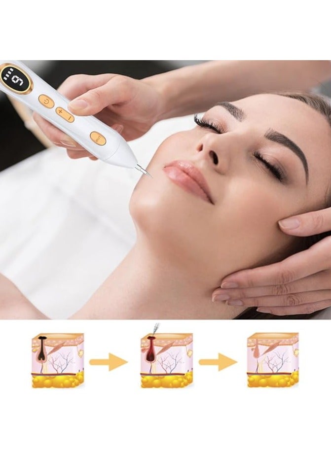 general Freckles Removal Pen, Skin Label Removal, Carry 9 Adjustable Gears, Painless Moles, Warts, Imperfections, Set, Women's Plasma Technology, LED Screen, Full Body White - Image 4