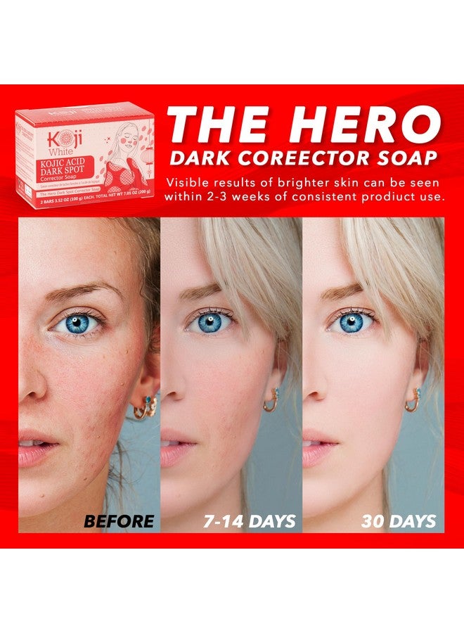 koji white Oji White Kojic Acid Dark Spot Corrector Soap Kojic Acid Soap With Vitamin C Licorice Root Niacinamide Glycolic Acid Hyaluronic Acid Vitamin E Ceramide Exfoliating &AmpAmp;Amp;Amp; Brightening 2 Bars - Image 3