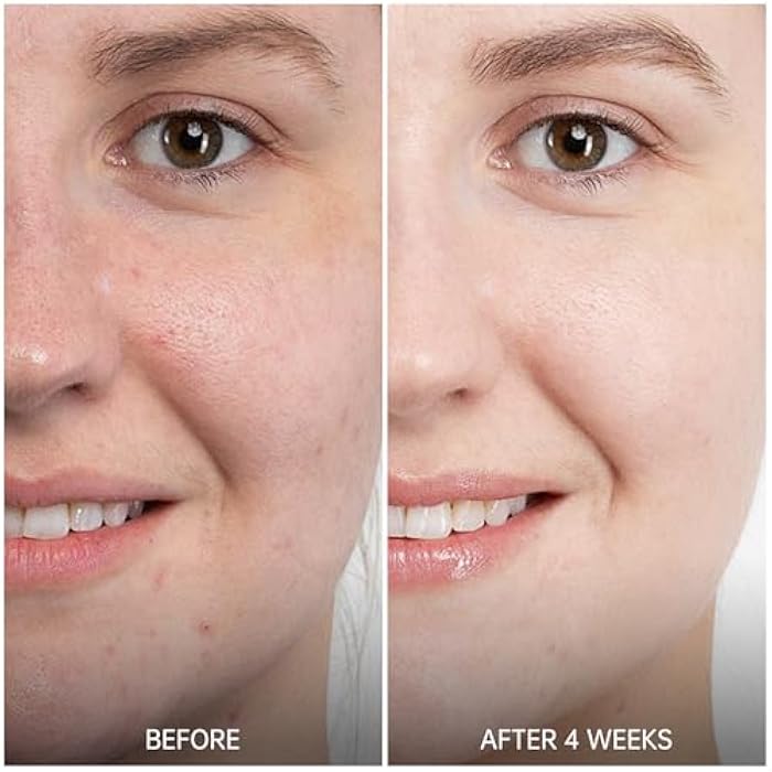 VGO Retinol Serum for Face, Resurfacing Retinol Serum with Hyaluronic Acid, Niacinamide and Ceramides, Hydrating and Refreshing, Wrinkle Smoothing, Suitable for Sensitive Skin (1 pack) - Image 2