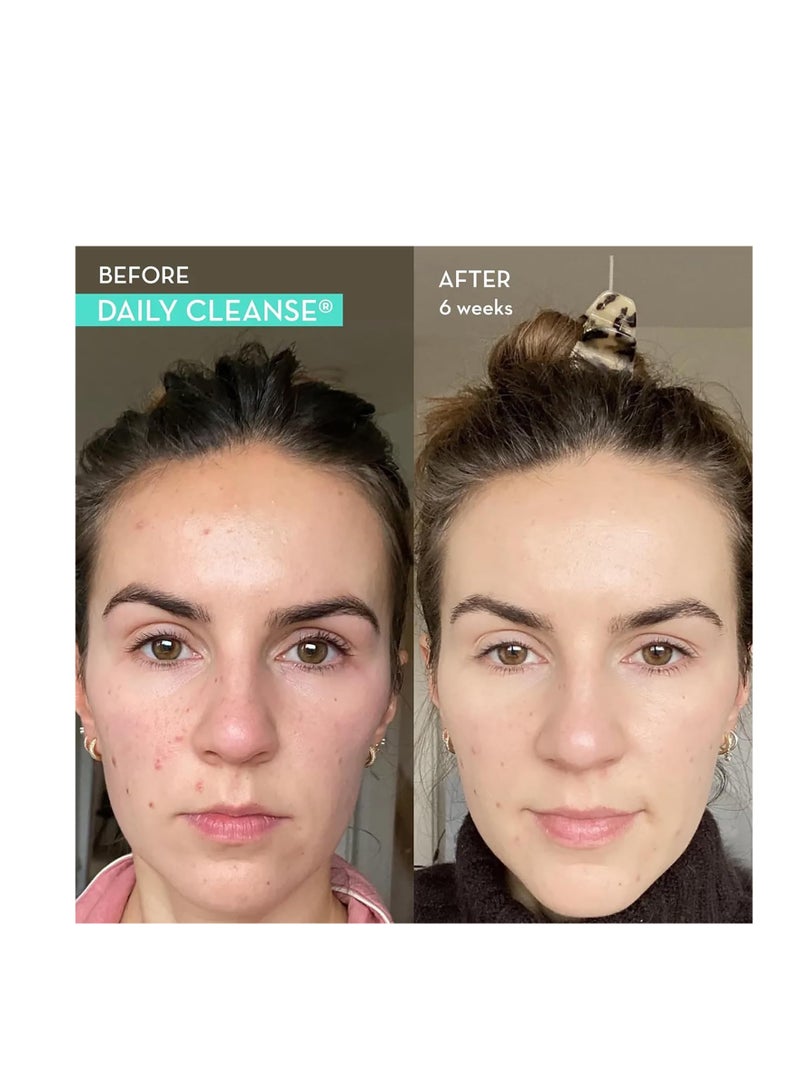 HUM Daily Cleanse Acne Supplement Gut Cleanse Detox for Clear Skin with Organic Algae, Detoxifying Herbs, Zinc & Spirulina Clear Skin Supplement 60 Capsules - Image 2