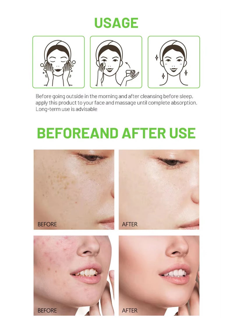 Disaar Disaar Anti Acne Salicylic Acid Facial Cream 120 G  - Image 5