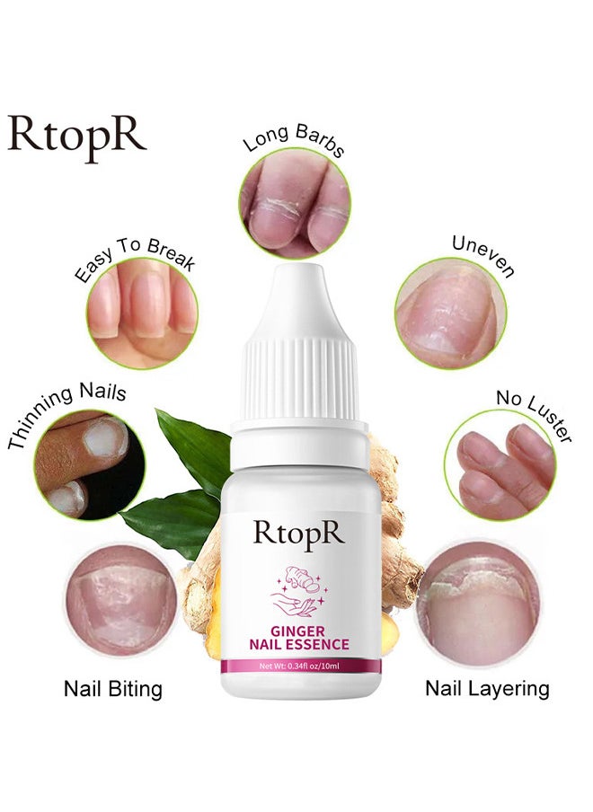 RtopR - Ginger Nail Repair Liquid Treatment Essence Oil Nail Anti Remove Nail Onychomycosis Fungus Toe Nourishing Brighten Nail Care - Image 1