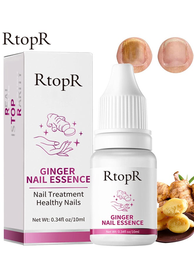 RtopR - Ginger Nail Repair Liquid Treatment Essence Oil Nail Anti Remove Nail Onychomycosis Fungus Toe Nourishing Brighten Nail Care - Image 1