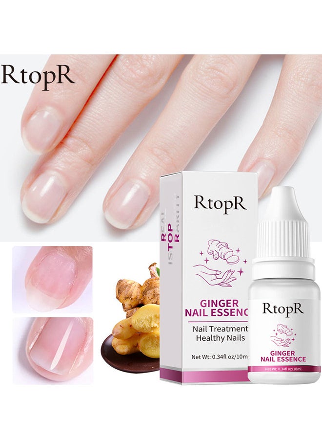 RtopR - Ginger Nail Repair Liquid Treatment Essence Oil Nail Anti Remove Nail Onychomycosis Fungus Toe Nourishing Brighten Nail Care - Image 1