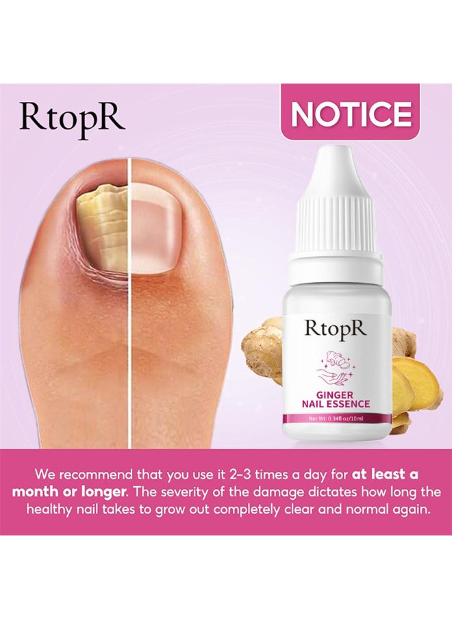 RtopR - Ginger Nail Repair Liquid Treatment Essence Oil Nail Anti Remove Nail Onychomycosis Fungus Toe Nourishing Brighten Nail Care - Image 1