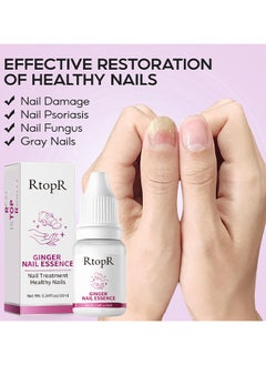 Ginger Nail Repair Liquid Treatment Essence Oil Nail Anti Remove Nail Onychomycosis Fungus Toe Nourishing Brighten Nail Care - pzsku/Z0C22F07C07692B0AB22DZ/45/_/1711078685/9edb26d1-3f9c-4297-9b0d-b4c2938134cf