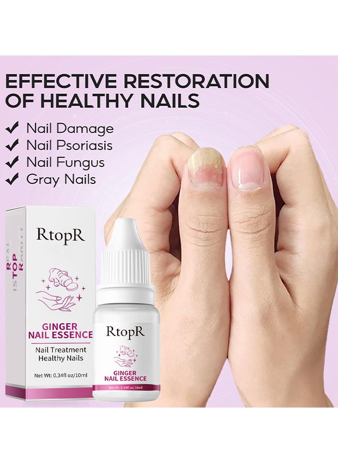 RtopR - Ginger Nail Repair Liquid Treatment Essence Oil Nail Anti Remove Nail Onychomycosis Fungus Toe Nourishing Brighten Nail Care - Image 1