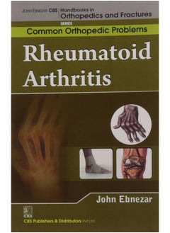 John Ebnezar CBS Handbooks in Orthopedics and Factures: Common Orthopedic Problems: Rheumatoid Arthritis - pzsku/Z0C2CEFAD04C2DAA2EFE3Z/45/_/1730195295/61b939ee-1c24-4996-9e2d-da63bb252543