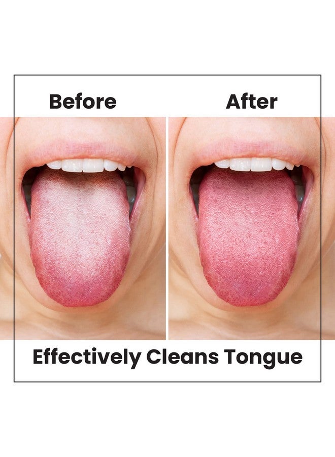 Lindo Eco-Friendly Tongue Cleaners, Tongue Scrapers, Oral Care Cleaners, Reduce Bad Breath, Soft Silicone Bristles, Natural, Vegan, 2 Pack - Image 3