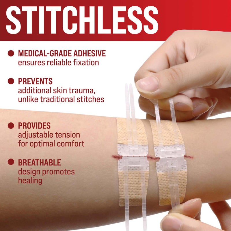 MYHELP Emergency Wound Closure Strips - 4pk - 2 Types Sutures Free Laceration Closure Kit - Stitchless & Easy to Use - Butterfly Bandages for Cut Care - Perfect for Quick Stop Bleeding and Wound Closing - Image 5