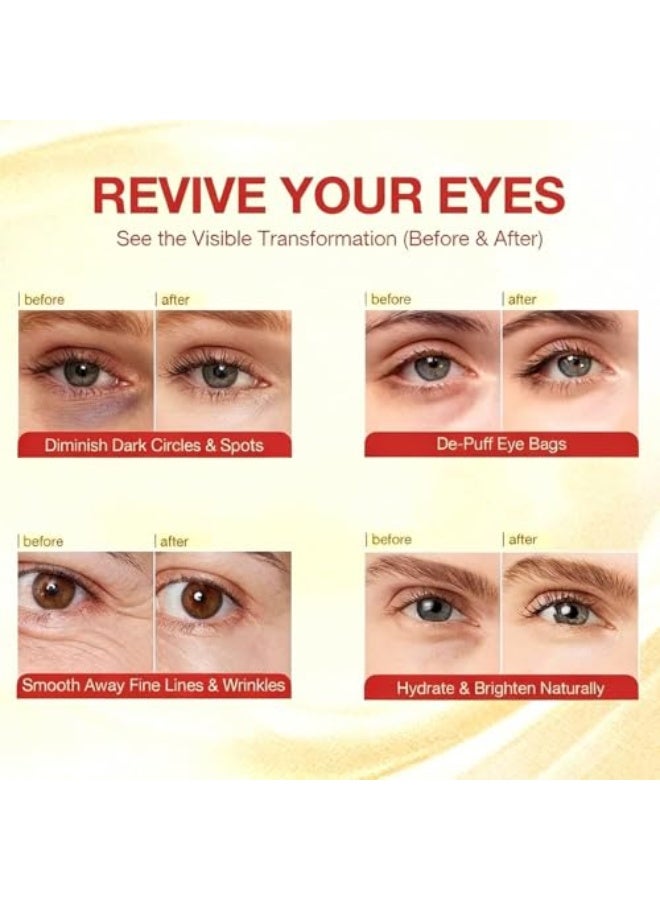 5 Pairs Under Eye Patches, Eye Masks with Bio-Collagen, Peptide Complex, Collagen Eye Patches for Puffy Eyes and Dark Circles, Make The Skin Around The Eyes Soft, Elastic and Delicate - Image 3