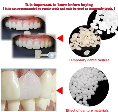 VEZE Temporary Tooth Repair Kit-Thermal Fitting Beads Granules and Fake Teeth for Temporary Moldable Fake Teeth and Thermal Beads Replacement Kit.【Teeth - Piece Yellow + White】 80Pcs - Image 3