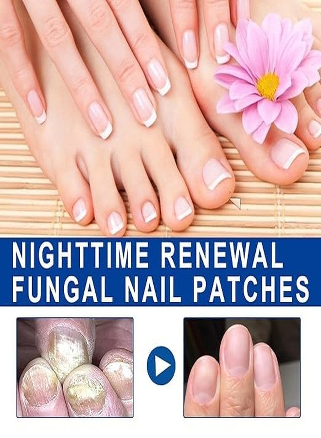 BUZZMEX New Advanced Fungal Nail Patch Treatment - Powerful Antifungal Solution | Targets Nail Fungus at the Root | Easy-to-Use Patch for Toenail & Fingernail | 20 Patches (pack-1) - Image 2