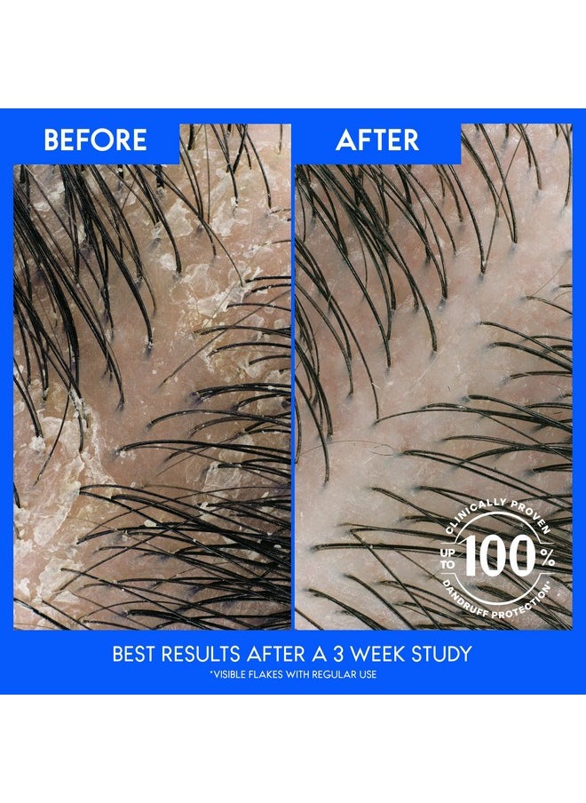 Head & Shoulders - Dandruff Shampoo To Clarify Scalp Infused With Apple Cider Vinegar 2 Count 32.1 Fluid Ounces - Image 1