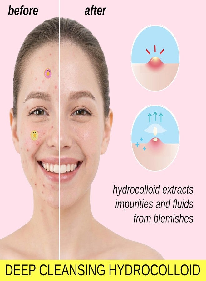 FOREVER 21 Blemish Patches 96pc Deep Cleansing Hydrocolloid Acne Stickers -Dounuts - Image 4