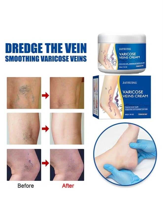 جايسوينغ كريم دوالي الأوردة - يُحسّن الدورة الدموية، ويُقلّل من الأوردة العنكبوتية والثقل، 50 غرامًا - Image 4