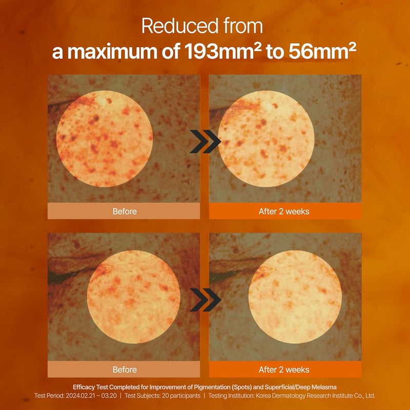 Shaishaishai CAFFEINE SHOT Blemish Toning Serum 10 Niacinamide 5 Caffeine for Hyperpigmentation Even Skin Tone Reduced Pore Size and Puffiness Pigmentation Care Korean Skin Care 101 Fl Oz - Image 4