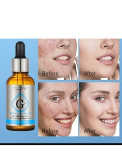 MELAO Glycolic Acid Facial Serum with Citric Acid + Salicylic Acid 30ml  - Image 4