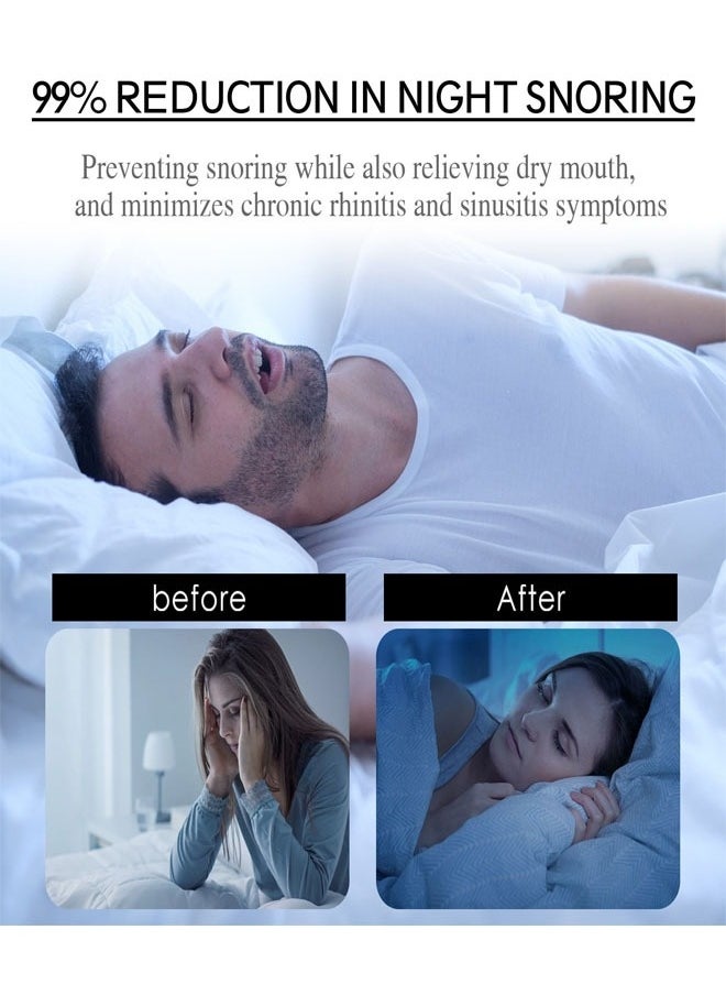 EELHOE - 30 Pcs Stop Snoring Breathe Easier Patch, Super Anti Snoring Solution for Men and Women, Clear the Way to Breathe Better Air, Reduce Snoring, Relieve Nasal Congestion Caused By Colds and Allergies - Image 1