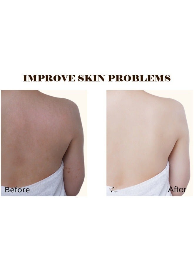 DAZZEL Glutathione Whitening Pills 60 Capsules 5000 Mg Effective Skin Lightening Supplement Dark Spots Melasma And Acne Scar Remover - Image 4