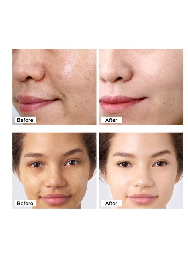 Goreem Retinol Face Cream Anti-aging Anti-oxidant Reduce Fine Lines Firming Whitening（30g）  - Image 2