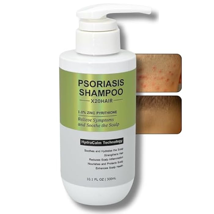 Psoriasis Shampoo for Men & Women 1% Zinc Pyrithione for Itchy, Flaky Scalp | Hydrating Daily Scalp Care with Aloe,Hyaluronic Acid & Botanical Extracts | Hydrating Dandruff Formula - Image 1