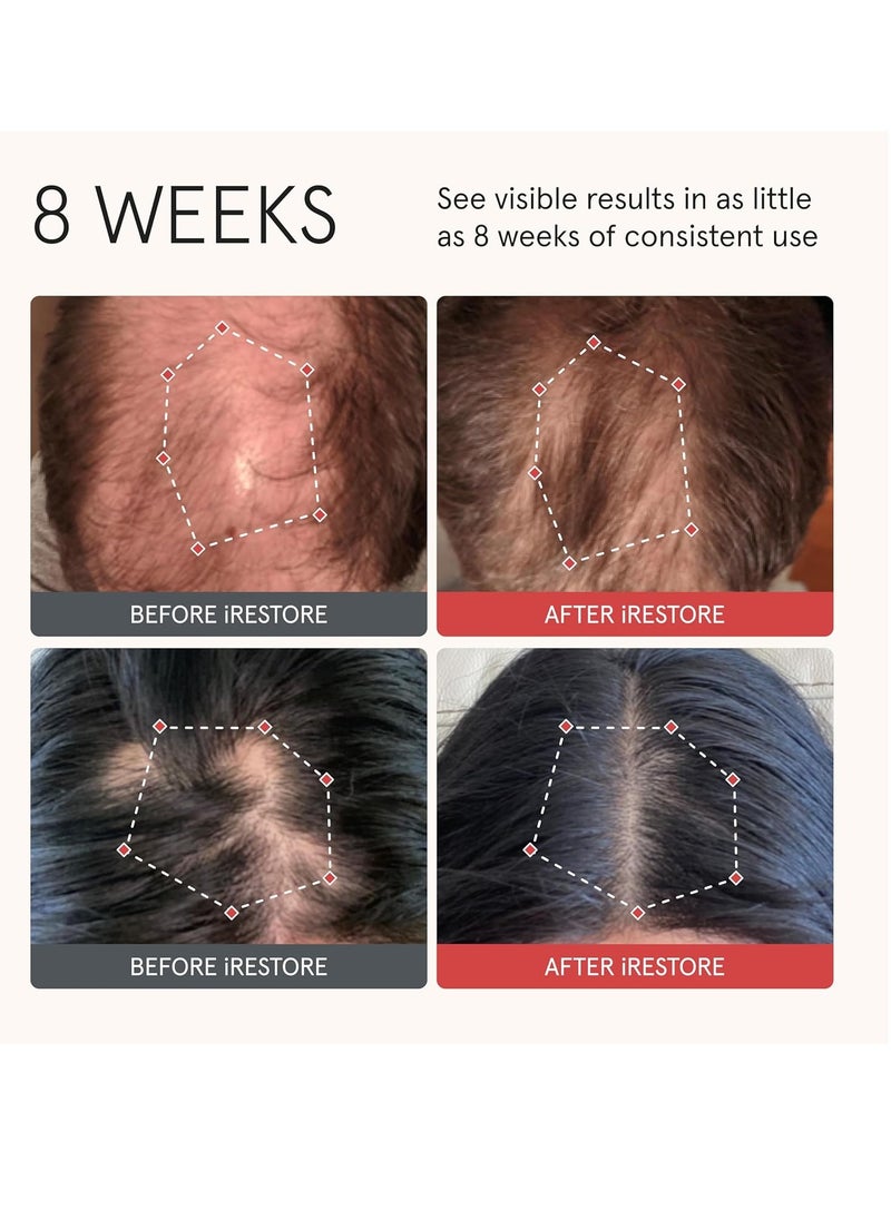iRestore iRESTORE Biotin Hair Conditioner for Damaged Dry Hair - Biotin Conditioner for Fine Hair Growth, Volumizing Thickening Conditioner with Ginseng & Argan Oil to Moisturize, Pair With Hair Loss Shampoo  - Image 2