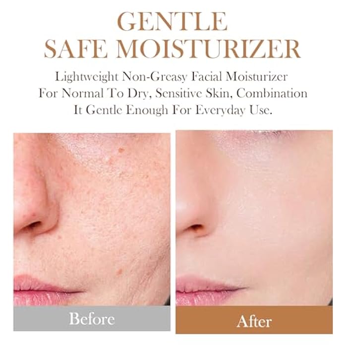 IREV كريم ترطيب الأرز IREV، مرطب وجه مرطب للبشرة الجافة والمختلطة، كريم وجه يومي، يستهدف الجفاف، يقوي حاجز البشرة، خفيف الوزن، سريع الامتصاص 1.76 أونصة 50 جرام - Image 2