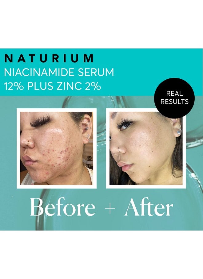 NATURIUM - Naturium Niacinamide Face Serum 12% Plus Zinc 2%, Anti-Aging, Pore Minimizer & Dark Spot Corrector with Hyaluronic Acid & Vitamin E, Vegan & Cruelty-Free, 1 oz - Image 1