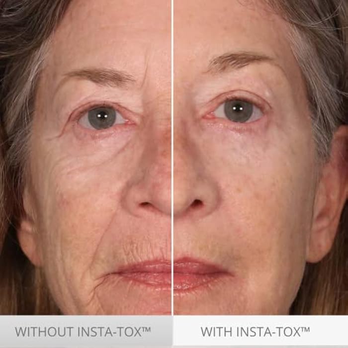 Serious Skincare INSTA-TOX Instant Wrinkle Smoothing Skin Serum TRIO - Temporarily Tightens Face - Instantly Reduce Appearance of Lines, Wrinkles & Large Pores - For Women & Men - .75 Fl. Oz. (3Pack) - Image 4