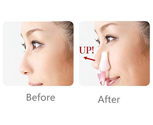AlexVyan 2 Pcs Different Model Nose Up Clip Shaping Lifting Bridge Straightening Nose Up Beauty Clip High Lifting Clipper Correction Shaper For Shaping Beauty Tool - Image 3