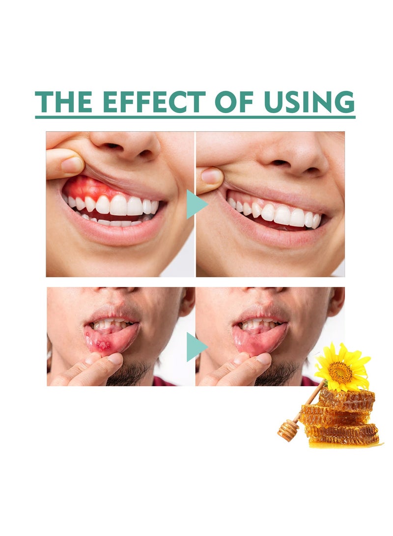 EELHOE Mouth Relief Spray,25ml Gum Protect Repair Spray, Instant Gum Soothing Spray, Relieve Gum Swelling And Toothache, Whiten Teeth, Reduce Gum Recession - Image 5