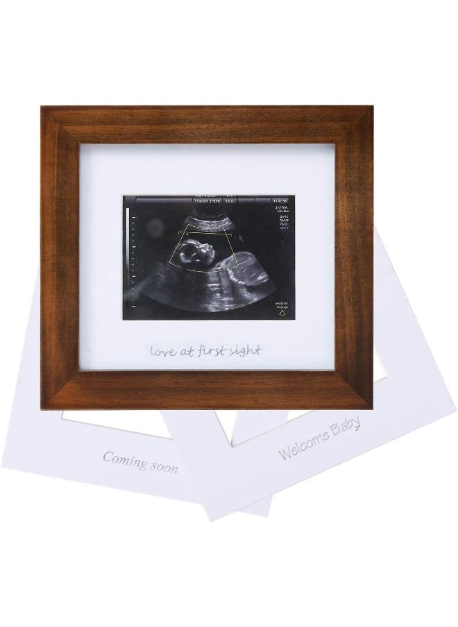 IHEIPYE IHEIPYE Baby Sonogram Photo Frame - 1st ultrasound picture frame - Idea Gift for Expecting Parents,Baby Shower, Gender Reveal Party,Baby Nursery Decor  - Image 1
